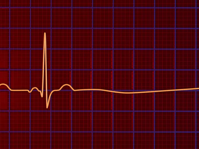 flatline